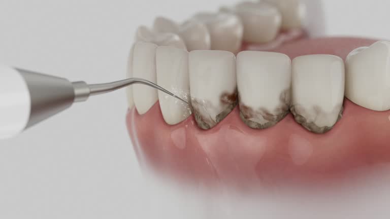 Reliable Tooth Extraction contractor in Monroe County County, MO by Dentist Open Now